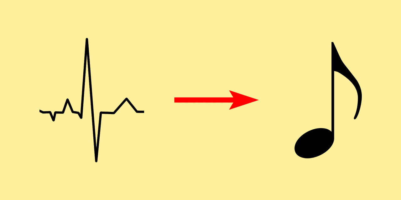 ECG-to-Music