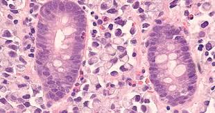 GitHub - kaylenemorrison/ccle-rna-seq-analysis: analysis of stomach ...