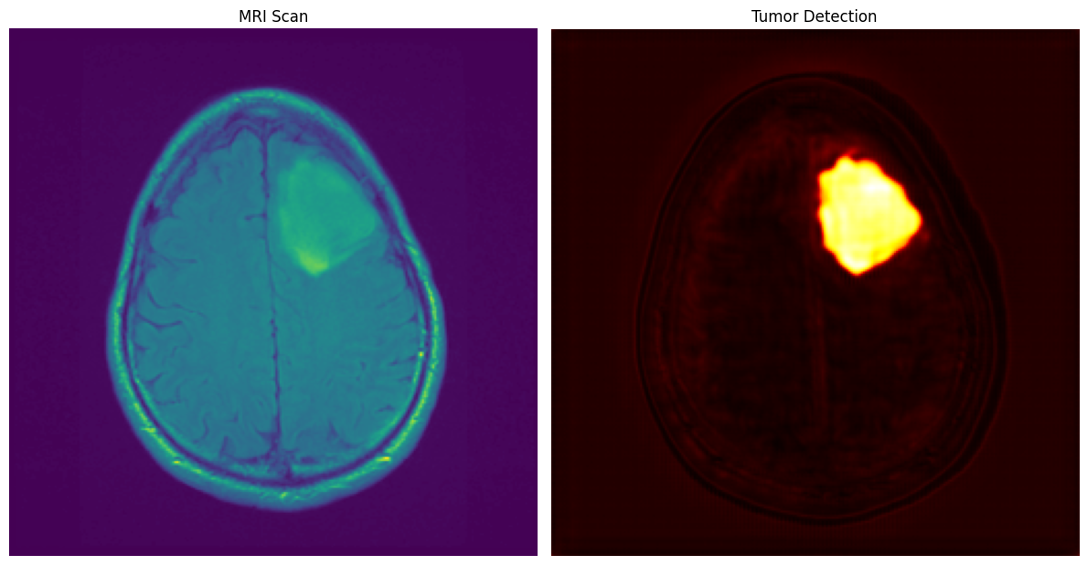 GitHub - yuvalrubinil/Brain-MRI-Tumor-Segmentator: A deep learning ...