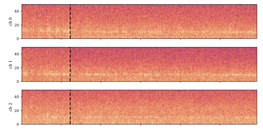 GitHub - ricsinaruto/brain-gen: Long-horizon brain signal generation ...