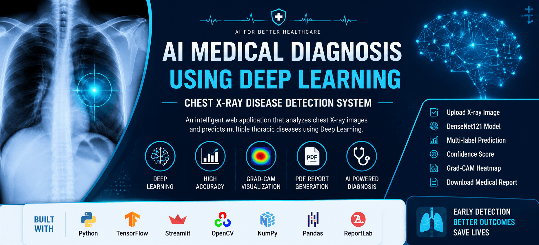 Medical-Diagnosis-of-Chest-X-ray-using-Deep-Learning