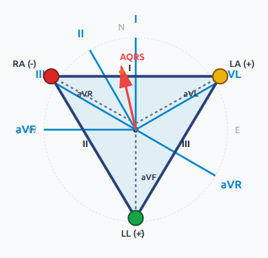 ecg-axis-lab