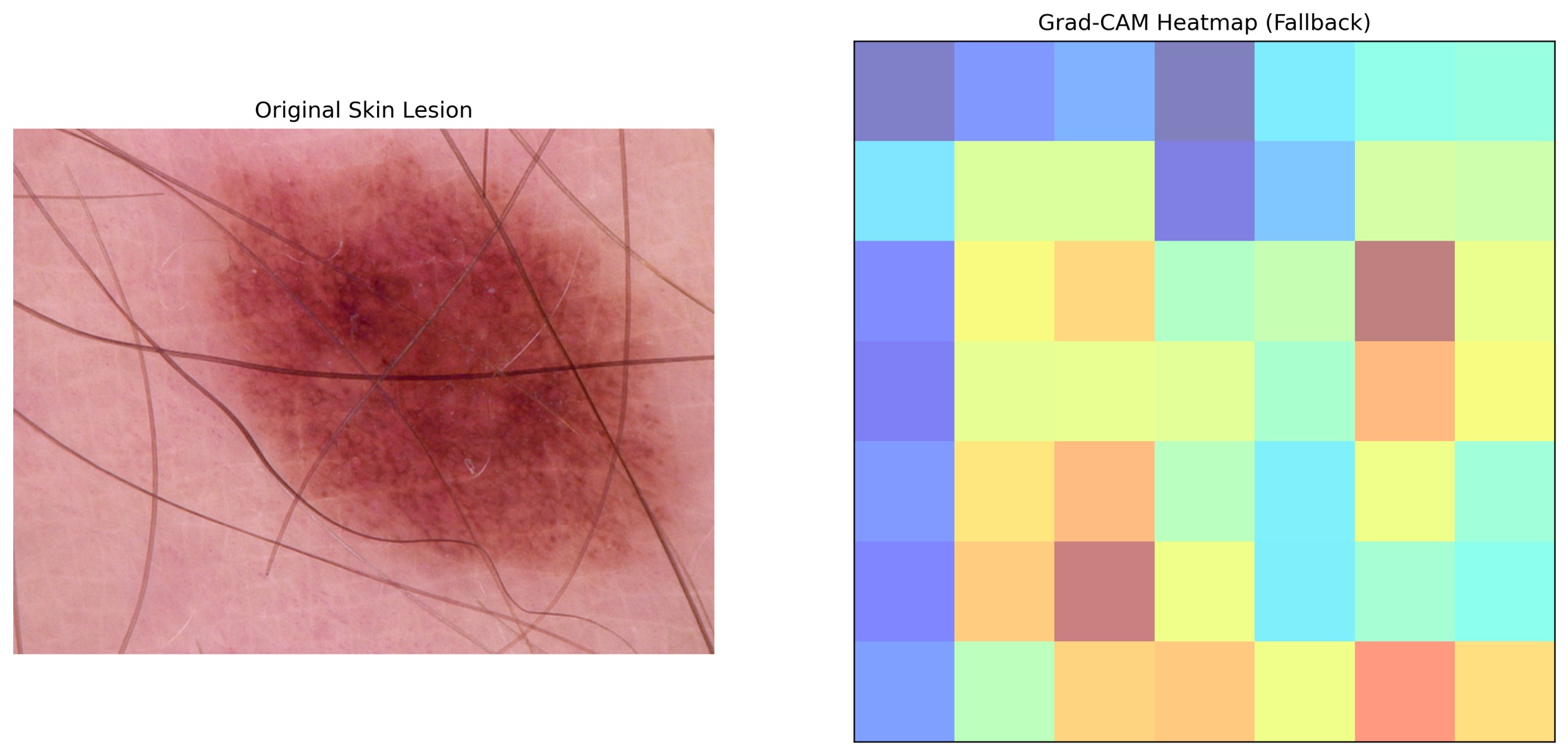 GitHub - kamrulkafi1/XAI-Medical-Imaging-GradCAM: Interpreting Deep ...