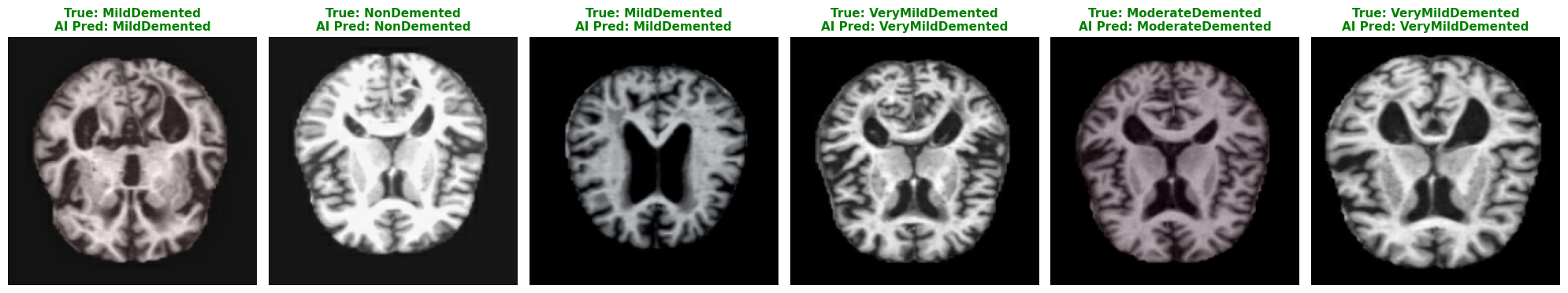 Dual-Pathway-AlzheimerDetect-AI-Model