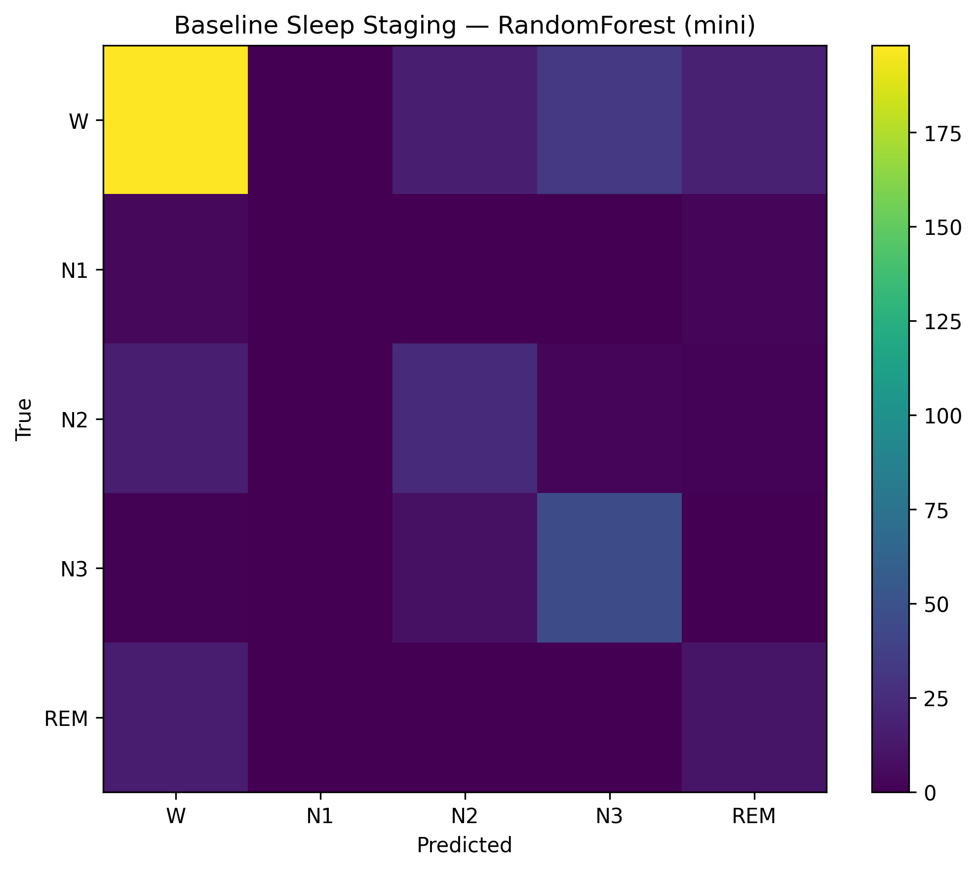 Sleep-Staging-Fragmentation-Detection