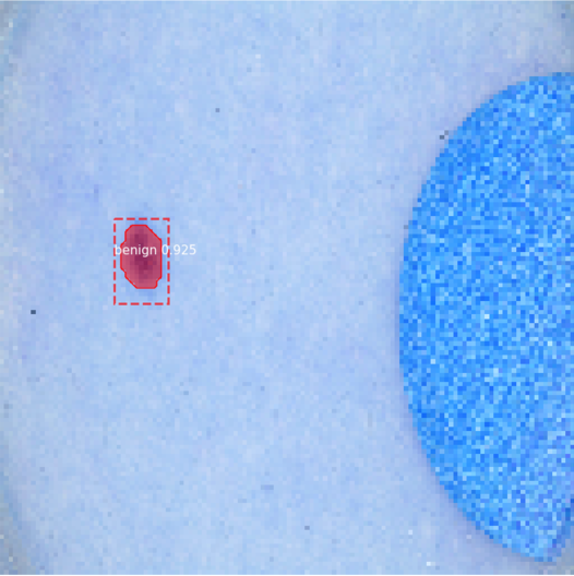 0x5eba/Skin-Cancer-Segmentation