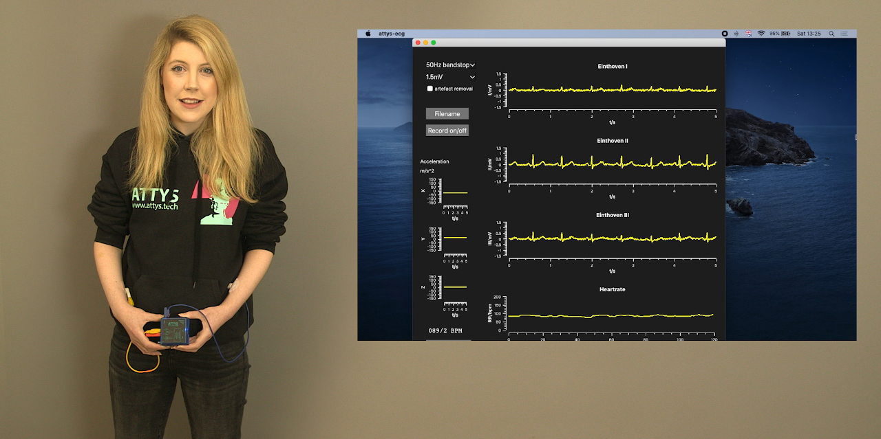 Ecg-qrs-detection · GitHub Topics · GitHub