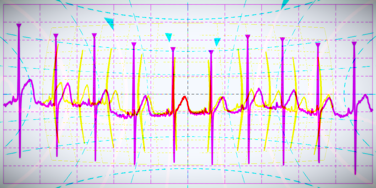 Heart-Rate-Tracking