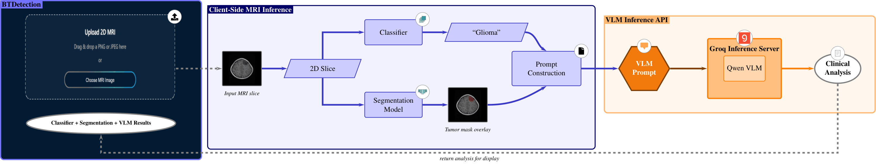 Brain_Tumor_Detection_Prototype