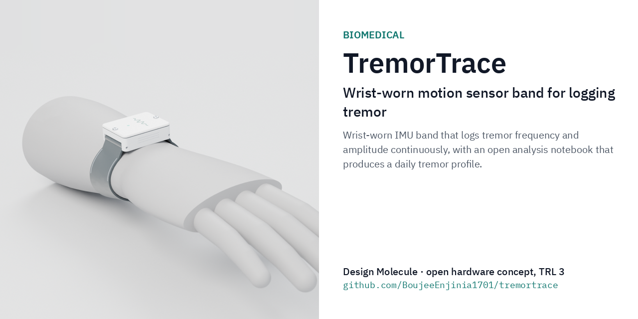 tremortrace