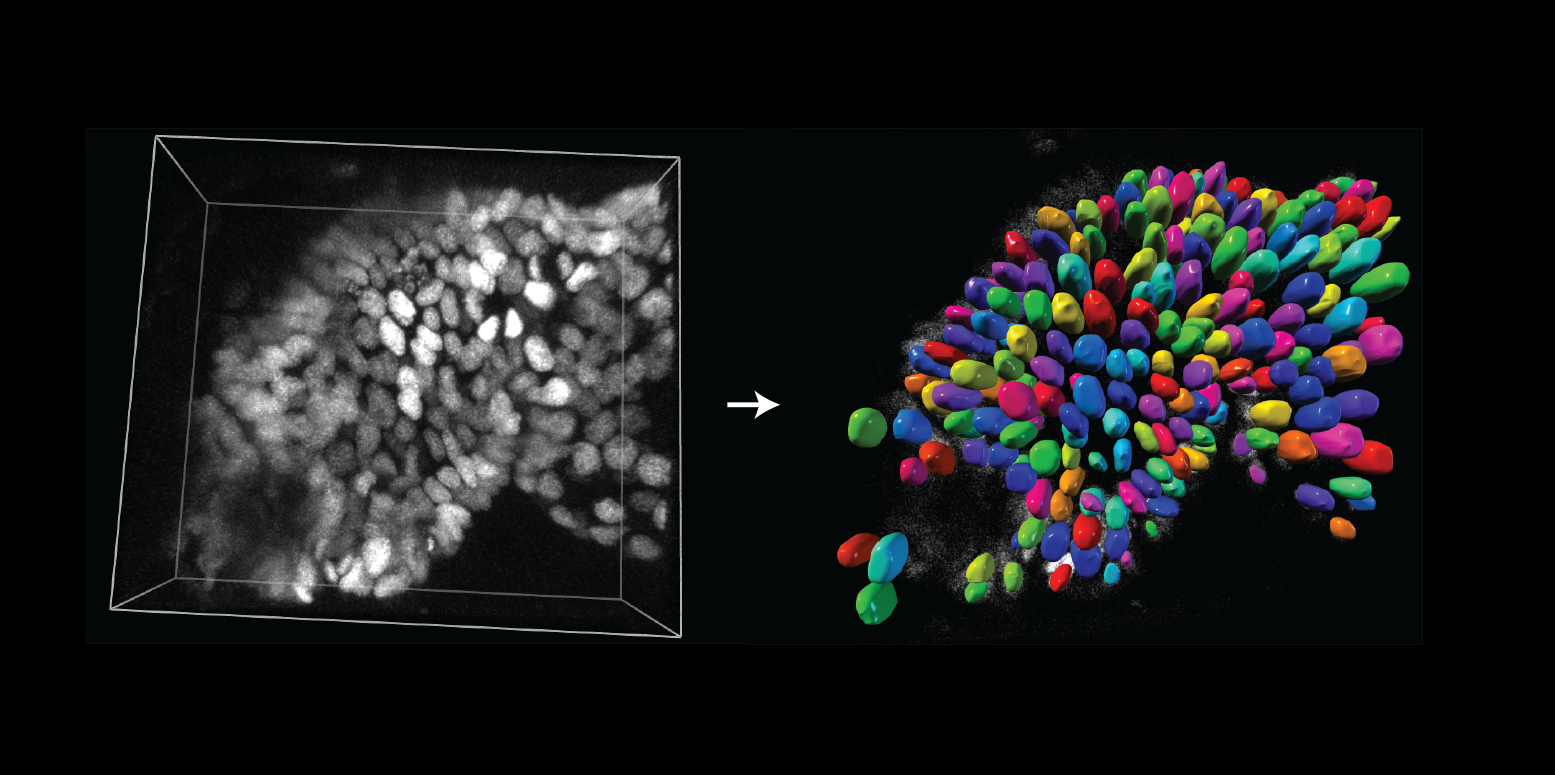 Cell segmentation hot sale deep learning