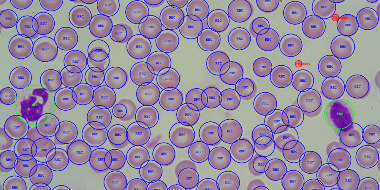 MahmudulAlam/Automatic-Identification-and-Counting-of-Blood-Cells