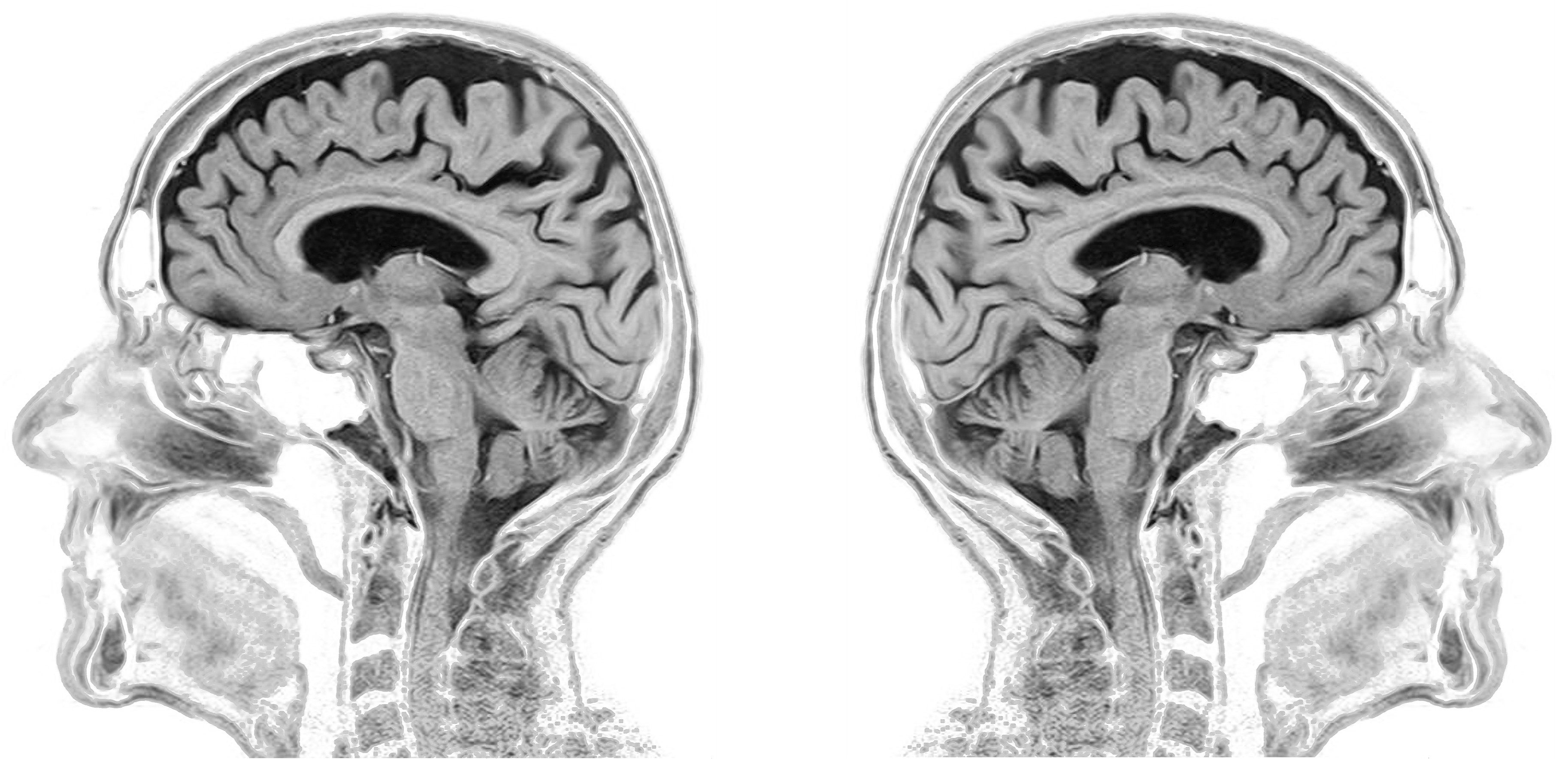 fmri_data_analysis