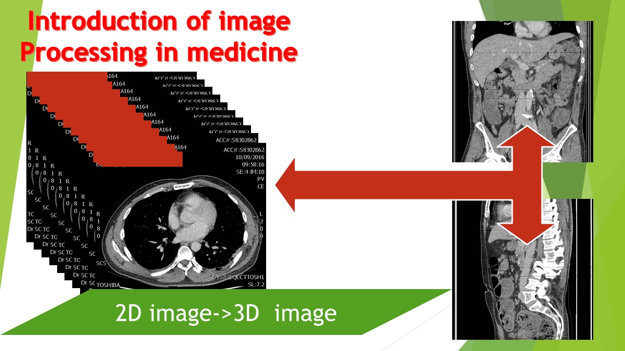 GitHub - YongJu114/3D_View_Generation_From_2D_Images_OPENCV: This ...