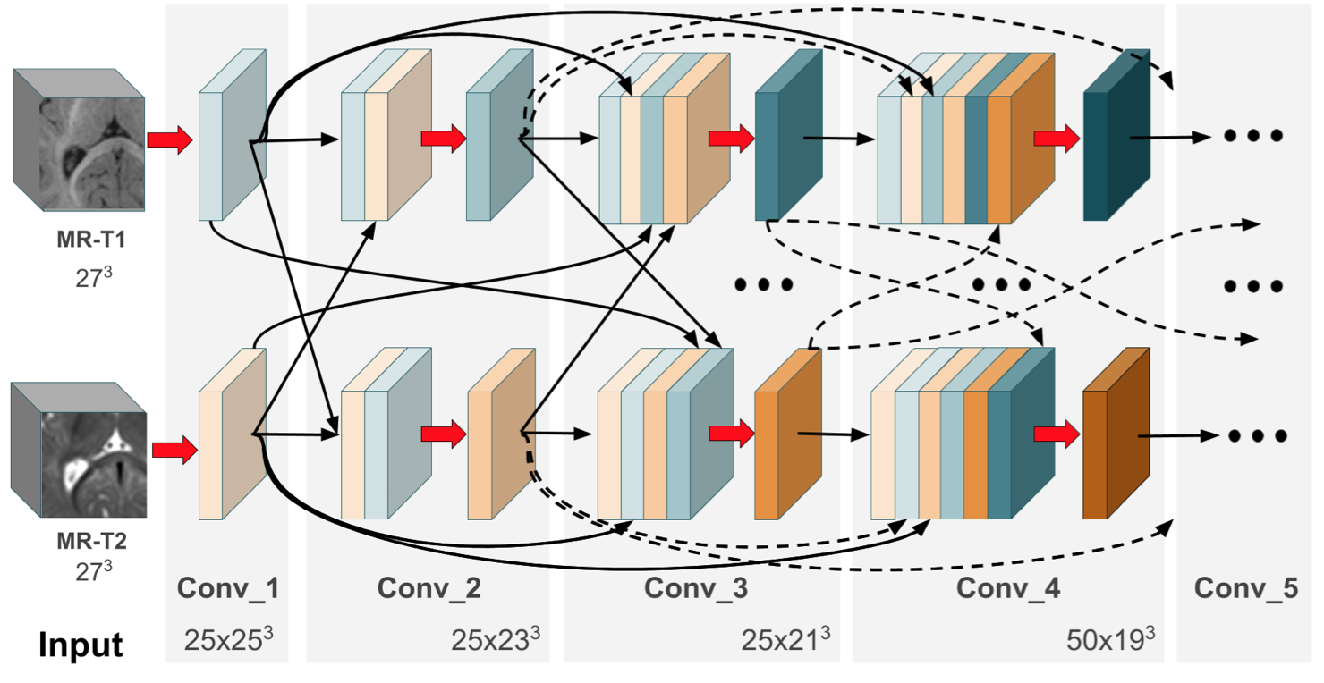 Github Josedolz Hyperdensenet Pytorch Pytorch Version Of The Hyperdensenet Deep Neural