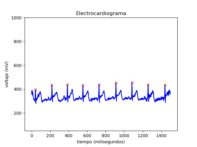 Electrocardiograma-Python-Arduino