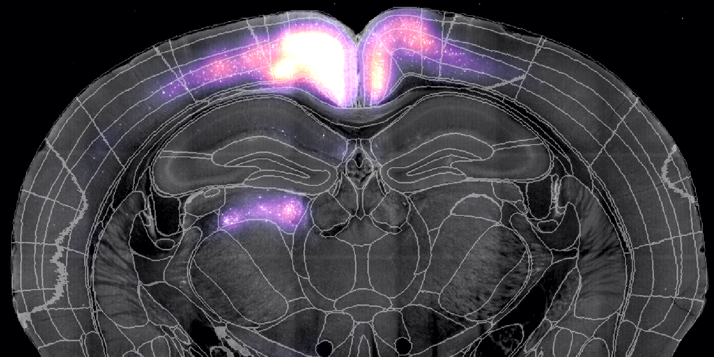 brainglobe/cellfinder