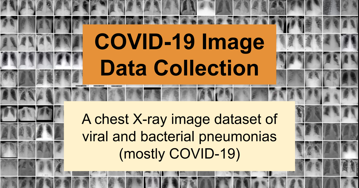 ieee8023/covid-chestxray-dataset