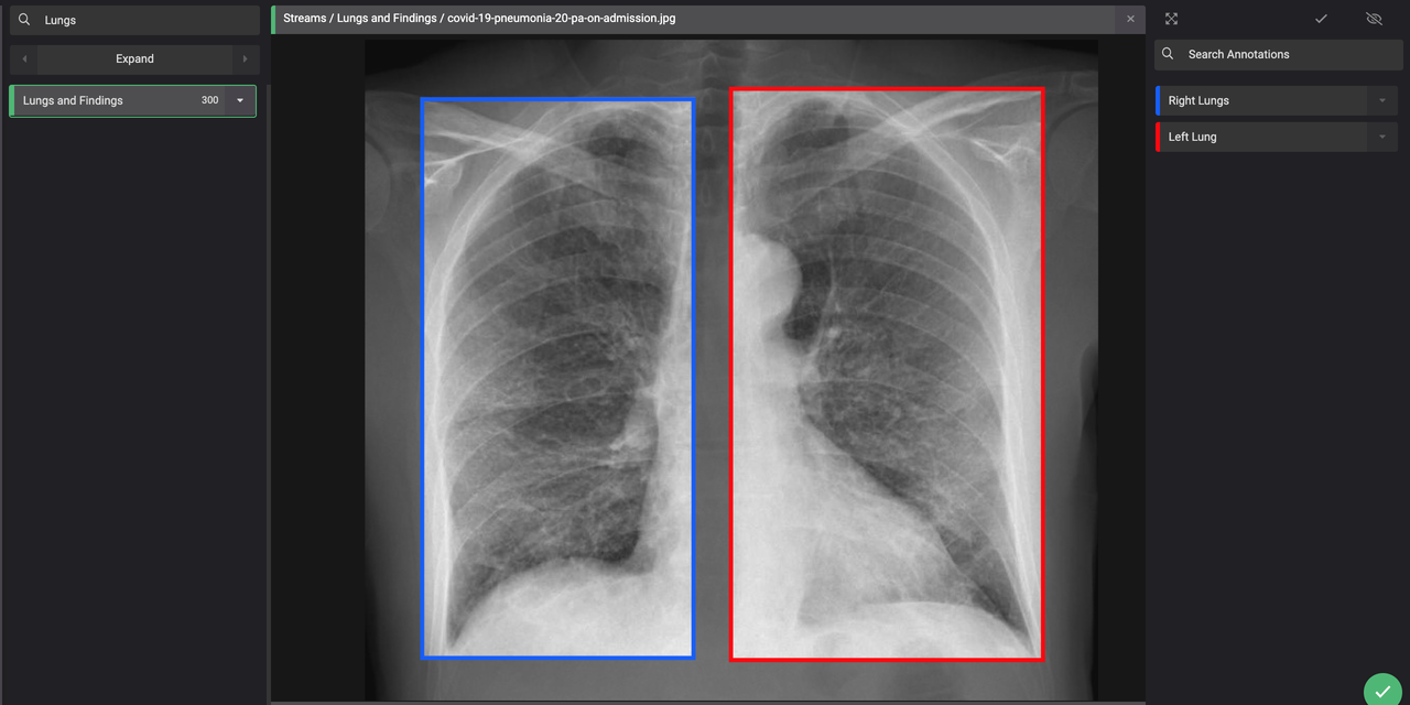 GitHub - GeneralBlockchain/covid-19-chest-xray-lung-bounding-boxes ...