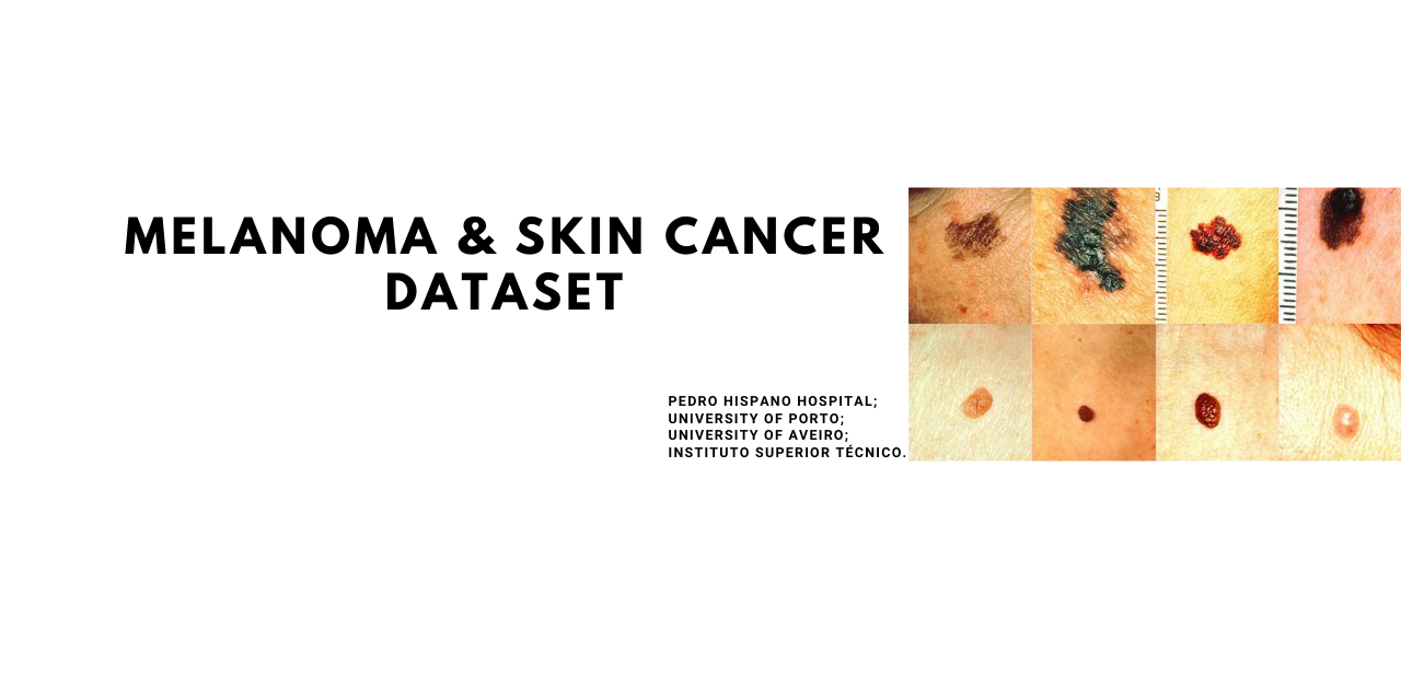 cancer-melanoma