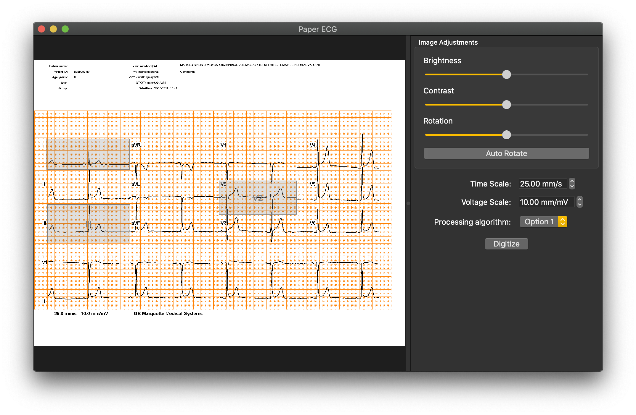 paper-ecg