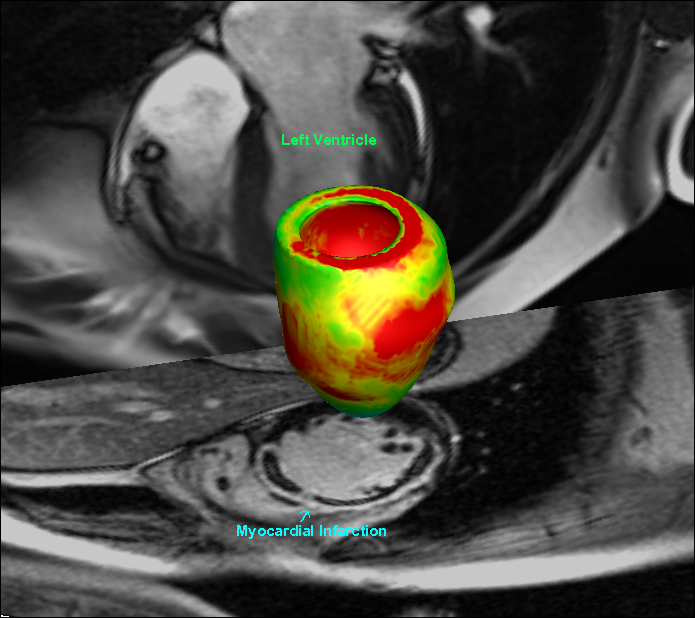 Github Haogao Glasgowheart Glasgowheart Platform For Personalized