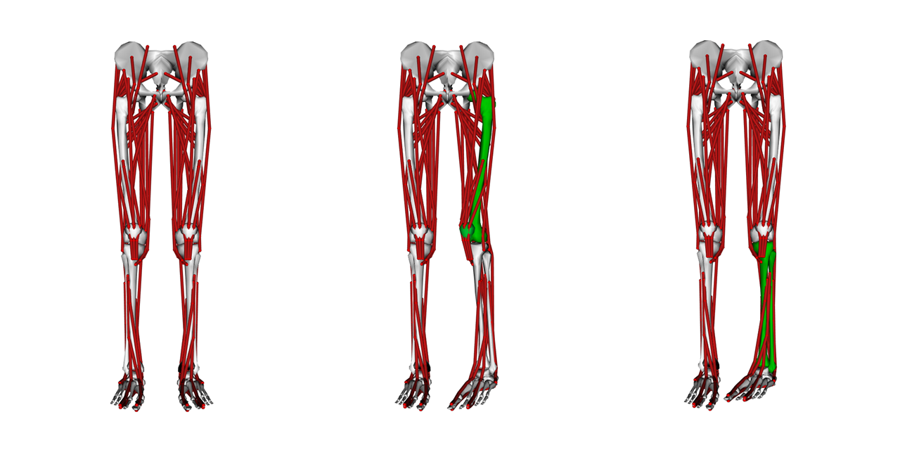 msk-bone-deformation