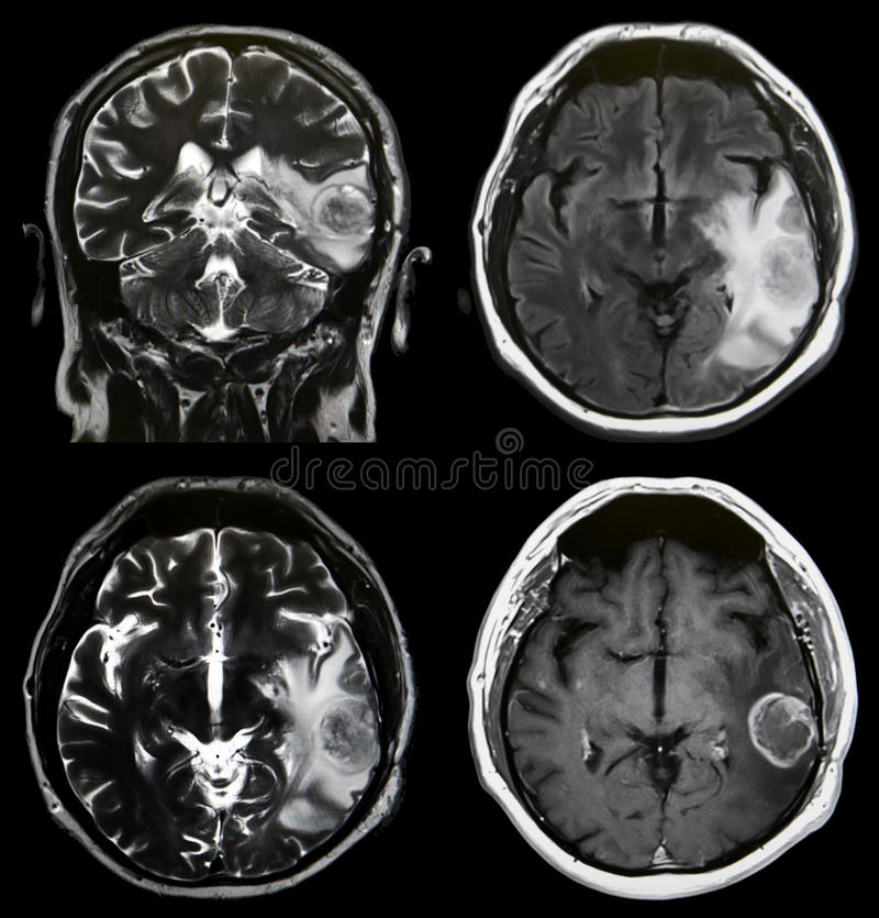 GitHub - Gabriele90/ML-in-medical-imaging: Recently, deep learning ...