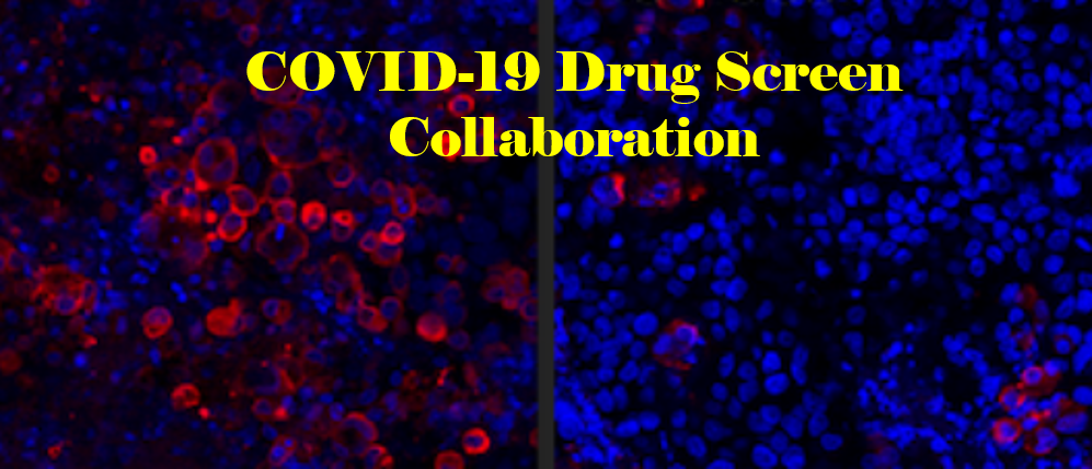 GitHub - RDaveyLab/COVID19: Codes for the manuscript