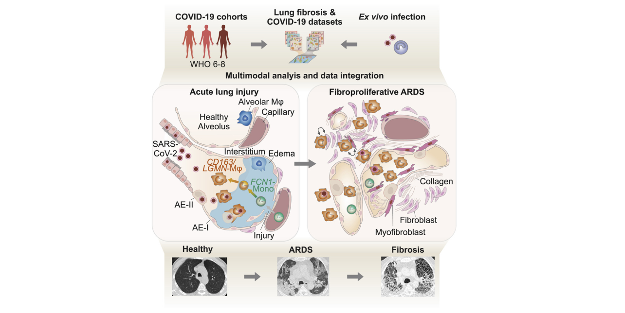 covid19-profibrotic-macrophages