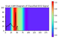 Ecg deep hot sale learning github