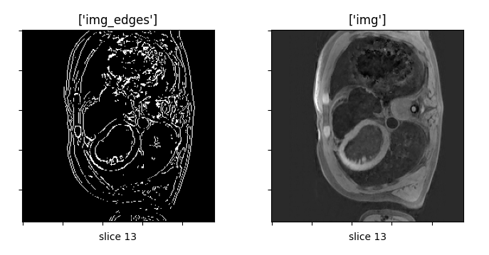 GitHub - IlvaHou55/canny_edge_detector_3D: Perform Canny edge detection ... image.