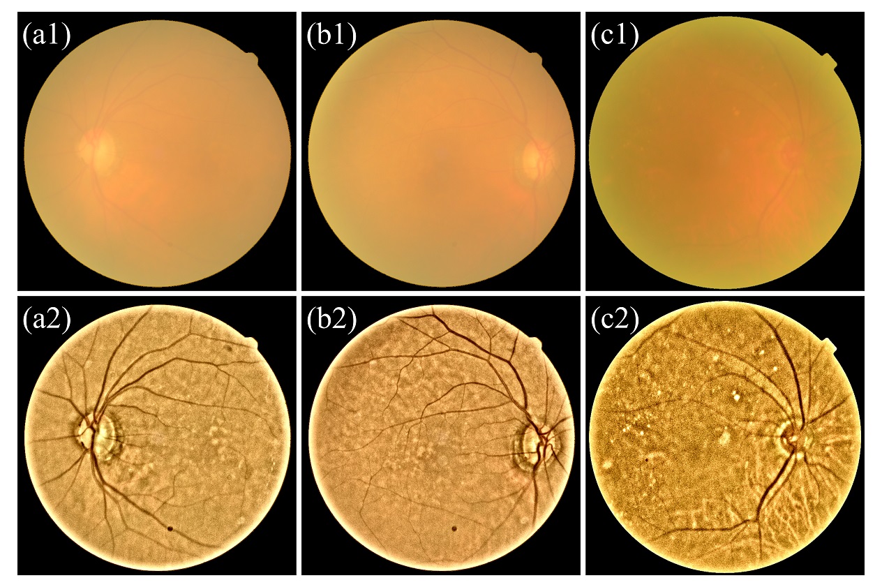 GitHub - ShuheZhang-MUMC/Double-Pass-Fundus-Reflection-model: A double ...