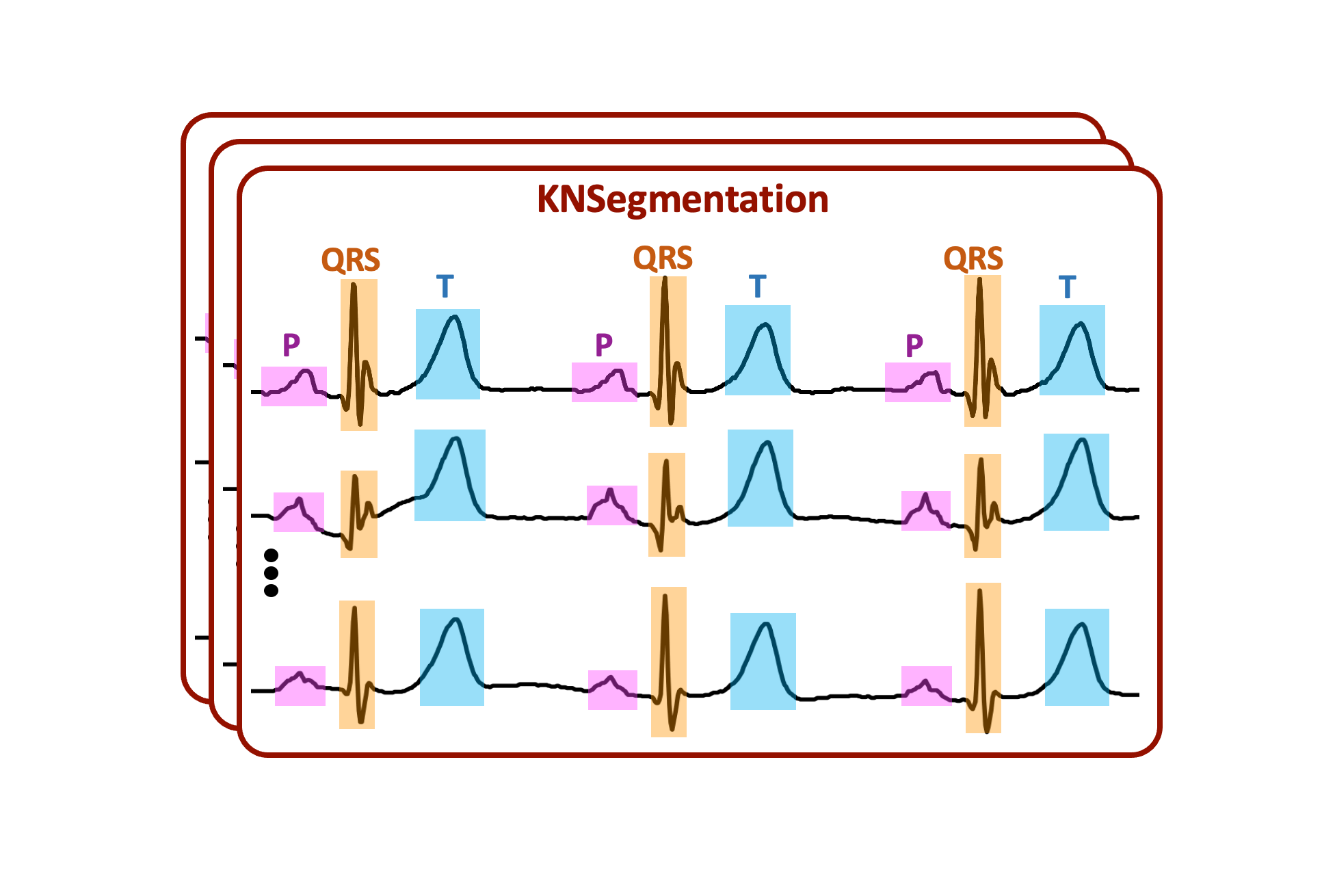 GitHub - KasraNezamabadi/KNSegmentation: A recursive method to segment ...