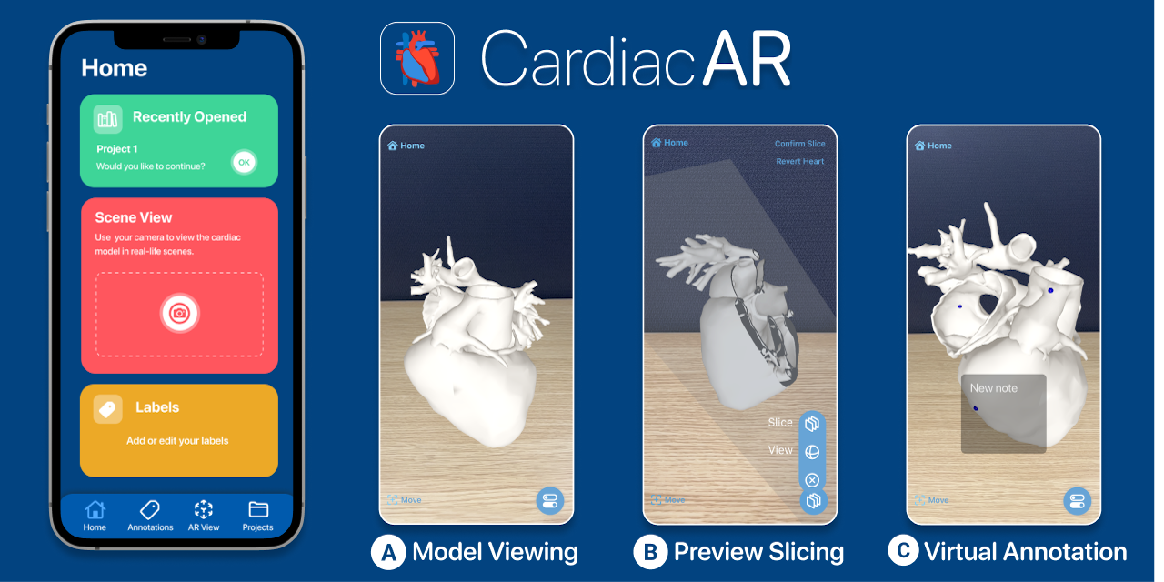 cardiacar