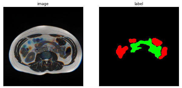 example-gi-tract/models.py at main · luminide/example-gi-tract · GitHub