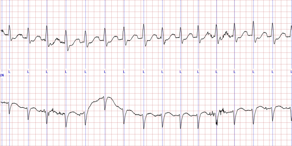 Artigo-Classificacao-de-ECG