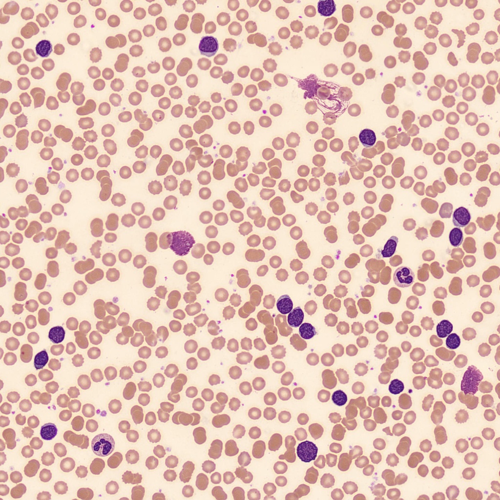 GitHub - kkuroma/RBC-schistocyte-detection: rbcfrontend
