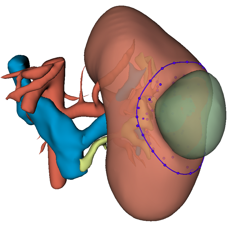 GitHub - JaspervanderZee/Virtual-Resection · GitHub