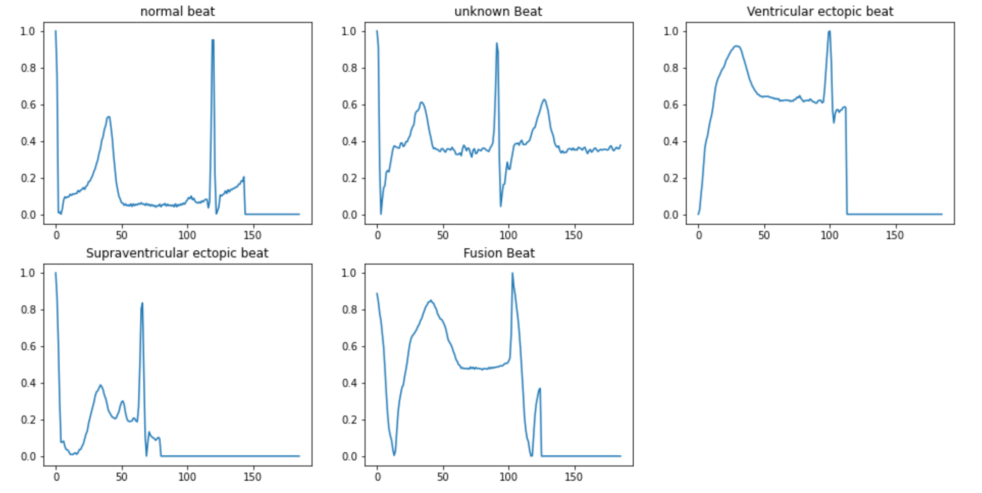 ECG