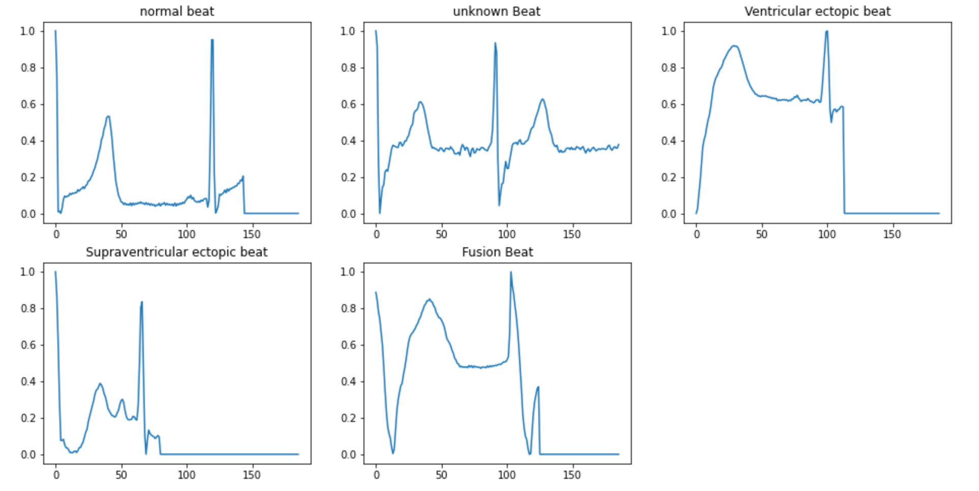 GitHub SamerKharboush ECG Overview The ECG Heartbeat Classification 