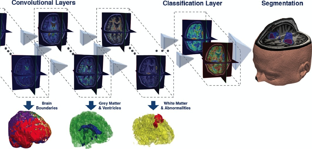 Top 10 GitHub Papers :: Semantic Segmentation | Master Data Science