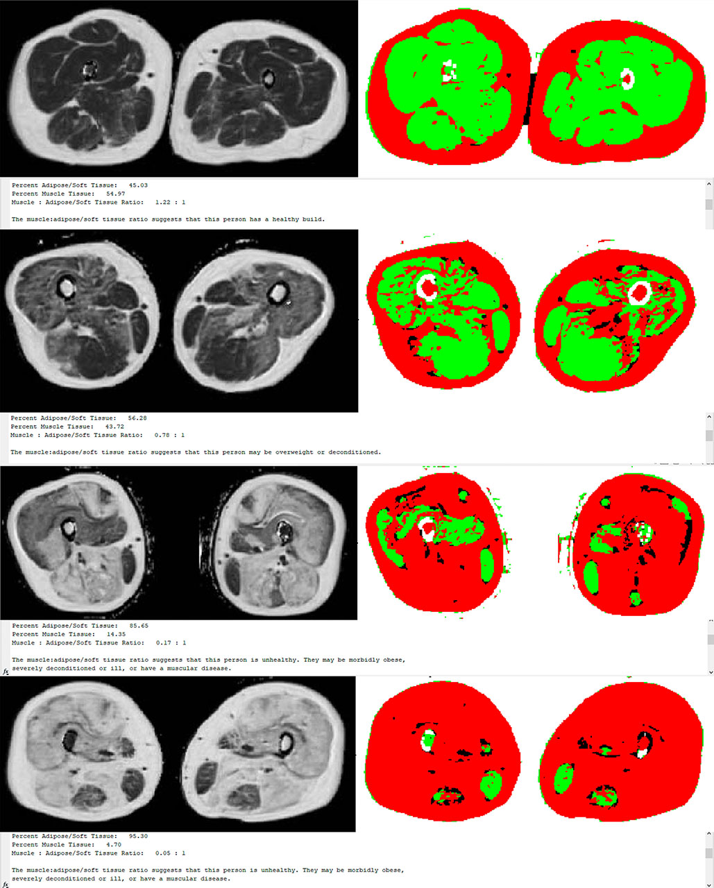 MRI-Tissue-Volume