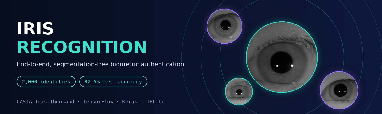 Iris-of-eyes-recognition
