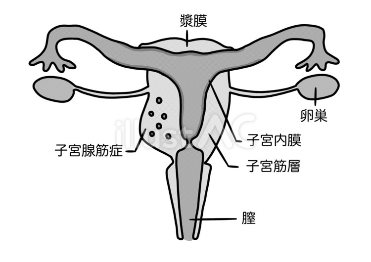 Binary_Classification_Of_Uterine-Myoma_ltrasound_Via_ResNet50_And ...