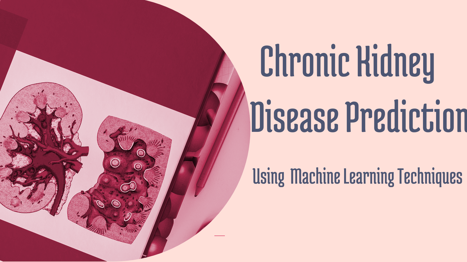 Chronic-Kidney-Disease-Prediction-Using-ML