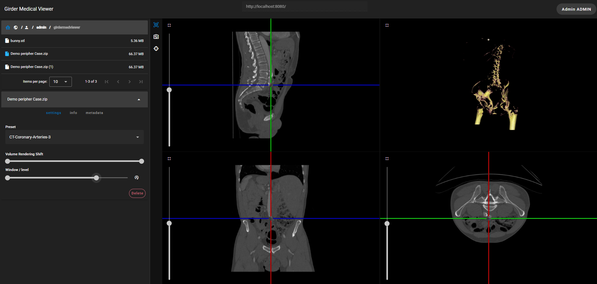 GirderMedViewer