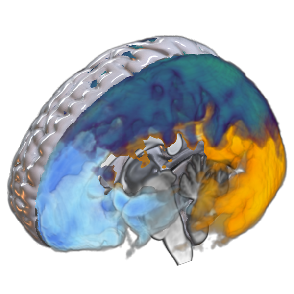 amyloid-ica-components