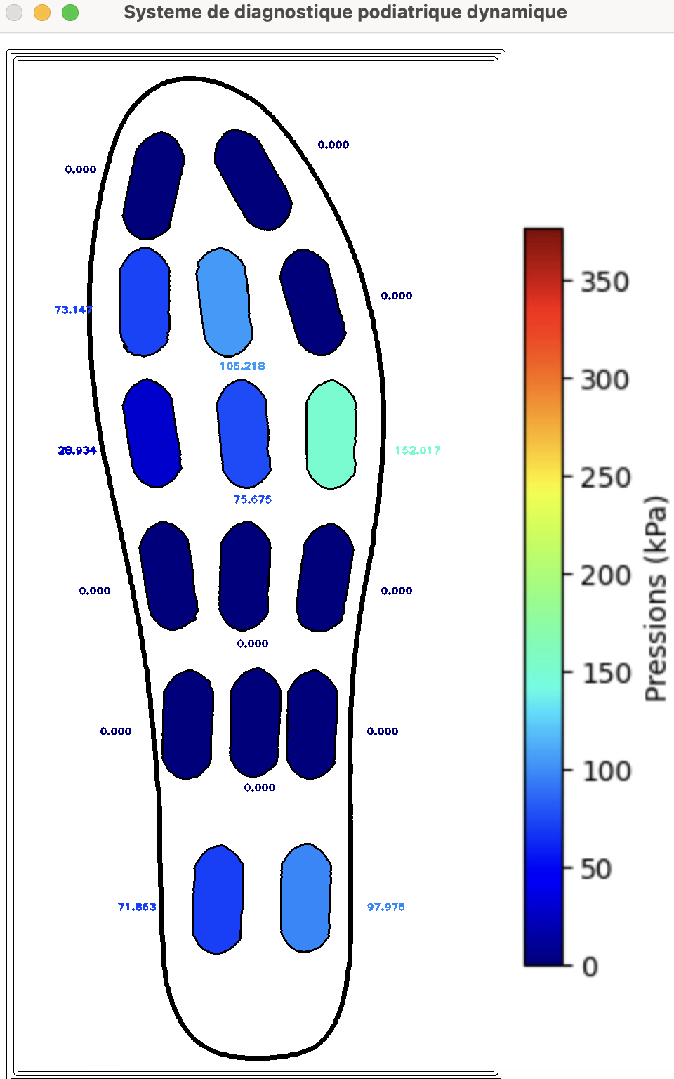 GitHub - LeoPovtinGagnon/Smart-insole-project: I designed a portable ...
