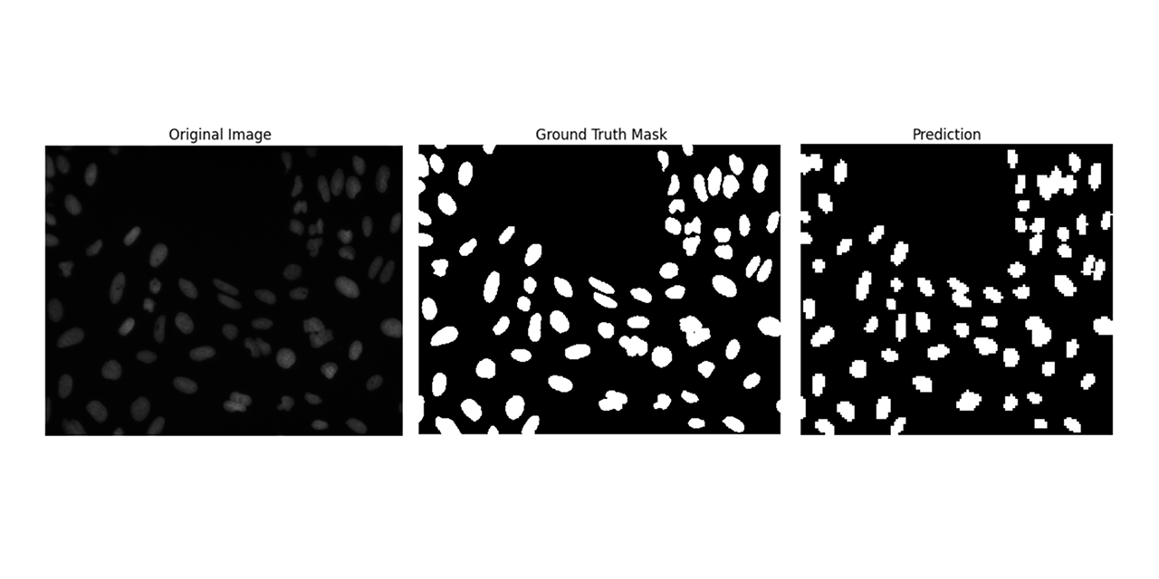 Nuclei-Segmentation